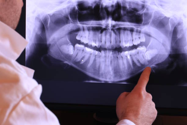 Best Emergency Tooth Extraction in Garland, UT