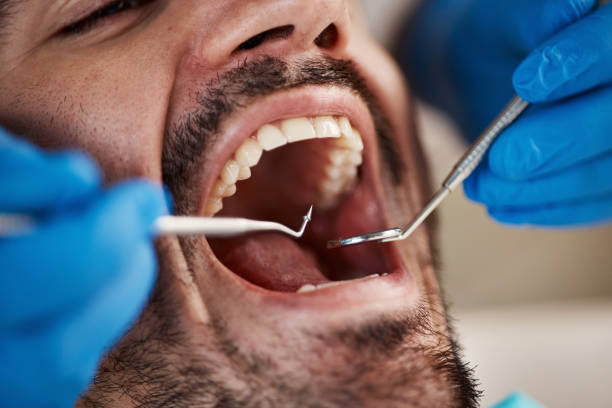 Best Walk-In Emergency Dentist in Garland, UT
