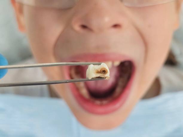 Best Emergency Orthodontic Repairs in Garland, UT