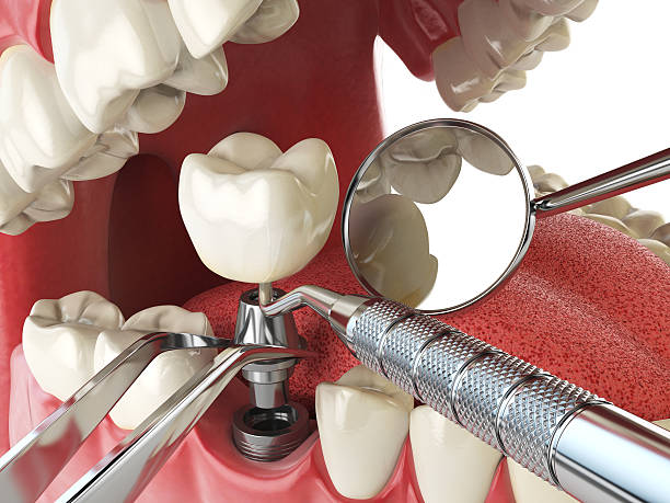 Professional Emergency Dentist in UT